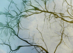 reflets-Vis-Madieres-1